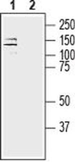 Alpha 3 Na+/K+ ATPase Antibody in Western Blot (WB)