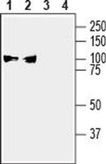 Alpha 3 Na+/K+ ATPase Antibody in Western Blot (WB)