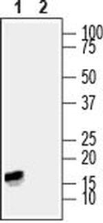 CPLX1/2 Antibody in Western Blot (WB)