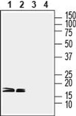 CPLX1/2 Antibody in Western Blot (WB)