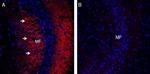 Synaptophysin Antibody in Immunohistochemistry (Frozen) (IHC (F))