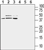 TREM2 (extracellular) Antibody in Western Blot (WB)