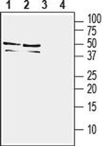 TREM2 (extracellular) Antibody in Western Blot (WB)