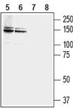 NCAM2 (extracellular) Antibody in Western Blot (WB)