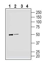 Parkin Antibody in Western Blot (WB)