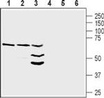 NRG1 (Neuregulin-1) (extracellular) Antibody in Western Blot (WB)