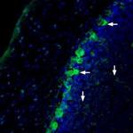 NRG1 (Neuregulin-1) (extracellular) Antibody in Immunohistochemistry (IHC)