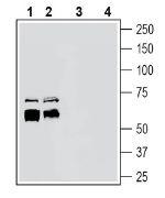 ADAM10 (extracellular) Antibody in Western Blot (WB)