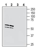 Neuronal Pentraxin 1 (NPTX1) Antibody in Western Blot (WB)