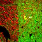 Neurotrophin 3 (NT-3) Antibody in Immunohistochemistry (Frozen) (IHC (F))