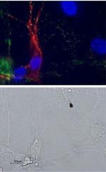 p75 NGF Receptor (extracellular) Antibody in Immunocytochemistry (ICC/IF)