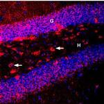 BDNF Antibody in Immunohistochemistry (Frozen) (IHC (F))