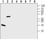 BDNF Antibody in Western Blot (WB)