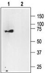 p75 NGF Receptor (intracellular) Antibody in Western Blot (WB)