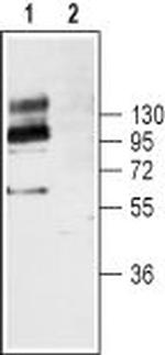 TrkB (extracellular) Antibody in Western Blot (WB)