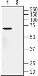 TNF Receptor I (extracellular) Antibody in Western Blot (WB)