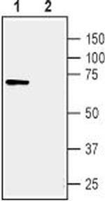 TNF Receptor I (extracellular) Antibody in Western Blot (WB)