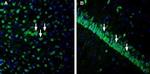 IGF1R (extracellular) Antibody in Immunohistochemistry (Frozen) (IHC (F))