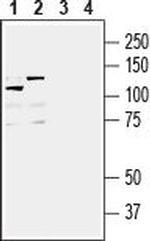 IGF1R (extracellular) Antibody in Western Blot (WB)