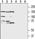 IGF1R (extracellular) Antibody in Western Blot (WB)