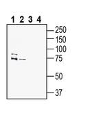 PMAT (SLC29A4) Antibody in Western Blot (WB)