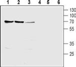 SLC28A1 (CNT1) Antibody in Western Blot (WB)