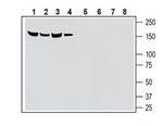 SLC28A3/CNT3 (extracellular) Antibody in Western Blot (WB)