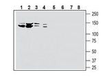 SLC28A3/CNT3 (extracellular) Antibody in Western Blot (WB)