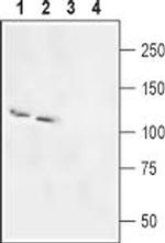 SLC4A5 (NBC4) Antibody in Western Blot (WB)