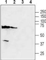 SLC47A2 Antibody in Western Blot (WB)