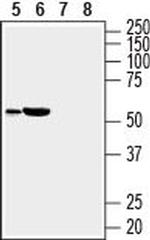 SLC35G1 (extracellular) Antibody in Western Blot (WB)