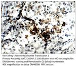 Adenine Nucleotide Translocator 2 Antibody in Immunohistochemistry (IHC)