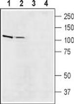 Na+/H+ Exchanger 5 (NHE-5) Antibody in Western Blot (WB)