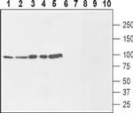 Na+/H+ Exchanger 1 (NHE-1) (extracellular) Antibody in Western Blot (WB)