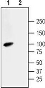 Na+/H+ Exchanger 3 (NHE-3) Antibody in Western Blot (WB)