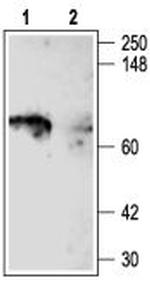 KV1.5 (KCNA5) Antibody in Western Blot (WB)