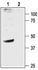 GIRK2 (Kir3.2) Antibody in Western Blot (WB)