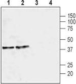 GIRK2 (Kir3.2) Antibody in Western Blot (WB)