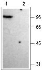 KV1.4 Antibody in Western Blot (WB)