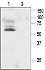 KV1.1 (KCNA1) Antibody in Western Blot (WB)