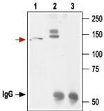 KCNH2 (erg1) Antibody in Immunoprecipitation (IP)