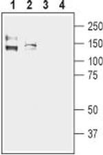 KCNMA1 (KCa1.1) (1097-1196) Antibody in Western Blot (WB)