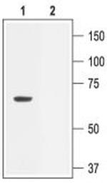 KCNN2 (KCa2.2, SK2) Antibody in Western Blot (WB)