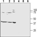 Kir4.1 (KCNJ10) Antibody in Western Blot (WB)