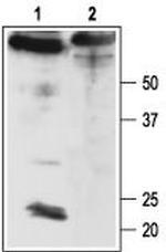 slo beta 4 (KCNMB4) Antibody in Western Blot (WB)