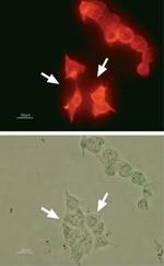 KCNH2 (HERG) Antibody in Immunocytochemistry (ICC/IF)