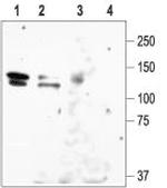 KCNH1 (EAG-1) Antibody in Western Blot (WB)