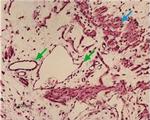 Kir6.1 (KCNJ8) Antibody in Immunohistochemistry (IHC)