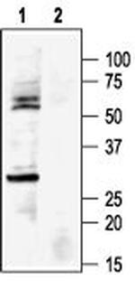 Kir6.1 (KCNJ8) Antibody in Western Blot (WB)