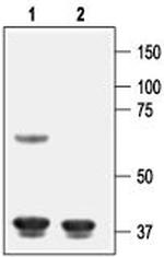 Kir6.1 (KCNJ8) Antibody in Western Blot (WB)